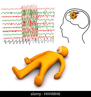 Unfall, Beleidigung, Anfall, Schlaganfall, Apoplexie, Passform, Frau, Gefahr, Gesundheit, Tod, Stockfoto