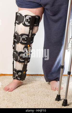 In der Nähe der weiblichen Bein tragen Corflex ganzes Bein Länge post-op Knie Unterstützung medizinische Hilfe Model Release: Ja. Property Release: Nein. Alle Bild für die Lizenzierung und Fine Art Prints. Kontakt details, vorzugsweise per e-mail oder Martin@carlssoninc.se Martin@martincarlsson.phot ography Stockfoto