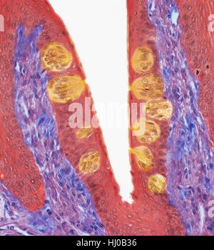 Geschmacksknospen. Farbiges Licht Schliffbild der Abschnitt durch die Zunge, Gaumen (rund, gelb) zeigt. Die Geschmacksknospen befinden sich Papillen (Projektionen) befindet sich auf der Oberfläche der Zunge. Gaumen sind meist auf Zunge gefunden sondern auch am Gaumen, Pharynx Epiglottis verstreut sind. Sie befinden sich in Epithelschicht (rot) haben Geschmack Pore, die Essen treffen Zunge ausgesetzt ist. Die fünf Arten des Geschmacks sind: süß, bitter, sauer, Salz Umami. Jeden Geschmack wird anerkannt, auf anderen Region Zunge, die Geschmacksnerven alle dieselbe Struktur aufweisen. Vergrößerung: x90when gedruckt bei 10 Zentimetern über Stockfoto
