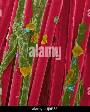 Wachs-Zahnseide mit Zahnbelag (braun), Bakterien (blau) Wange Zellen (orange) auf Zahnseide Fasern (rot), farbige scanning Electron Schliffbild (SEM) verwendet. Zahnbelag besteht aus Biofilm Bakterien in Glykoprotein Matrix eingebettet. Die Matrix wird aus bakterielle Sekrete Speichel gebildet. Die Stockfoto