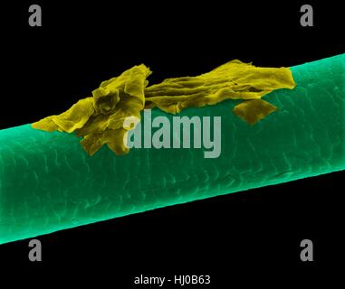 Menschliches Haar Schuppen, farbige scanning Electron Schliffbild (SEM). Die äußere Schicht des Haares (Cuticula) hat überlappende Schuppen aus Keratin. Diese Skalen werden gedacht, um zu verhindern, dass Haare Matten zusammen. Haar besteht aus faserigen Protein Keratin genannt. Intern gliedert sich Haarschaft in drei konzentrischen Hüllen (Schichten) genannt Medulla, Kortex äußeren Cuticula. Das Haar ist nicht lebendes Gewebe. Haare wachsen aus der Haarwurzel (Birne) in Haut eingebettet. Haarwuchs tritt auf, wenn die epidermale Zellen auf Basis der Haarwurzel teilen. Das Haar ist nicht lebendes Gewebe. Vergrößerung: X115 wenn kürzeste Achse bei 25 Millimetern gedruckt. Stockfoto