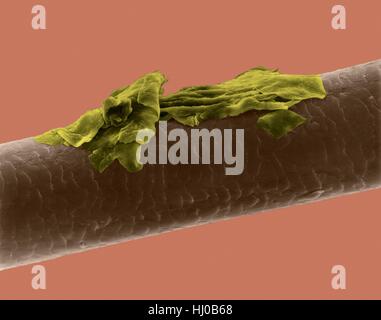 Menschliches Haar Schuppen, farbige scanning Electron Schliffbild (SEM). Die äußere Schicht des Haares (Cuticula) hat überlappende Schuppen aus Keratin. Diese Skalen werden gedacht, um zu verhindern, dass Haare Matten zusammen. Haar besteht aus faserigen Protein Keratin genannt. Intern gliedert sich Haarschaft in drei konzentrischen Hüllen (Schichten) genannt Medulla, Kortex äußeren Cuticula. Das Haar ist nicht lebendes Gewebe. Haare wachsen aus der Haarwurzel (Birne) in Haut eingebettet. Haarwuchs tritt auf, wenn die epidermale Zellen auf Basis der Haarwurzel teilen. Das Haar ist nicht lebendes Gewebe. Vergrößerung: X115 wenn kürzeste Achse bei 25 Millimetern gedruckt. Stockfoto