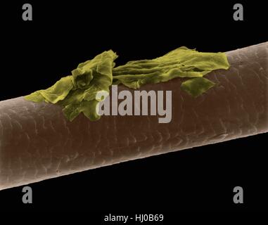 Menschliches Haar Schuppen, farbige scanning Electron Schliffbild (SEM). Die äußere Schicht des Haares (Cuticula) hat überlappende Schuppen aus Keratin. Diese Skalen werden gedacht, um zu verhindern, dass Haare Matten zusammen. Haar besteht aus faserigen Protein Keratin genannt. Intern gliedert sich Haarschaft in drei konzentrischen Hüllen (Schichten) genannt Medulla, Kortex äußeren Cuticula. Das Haar ist nicht lebendes Gewebe. Haare wachsen aus der Haarwurzel (Birne) in Haut eingebettet. Haarwuchs tritt auf, wenn die epidermale Zellen auf Basis der Haarwurzel teilen. Das Haar ist nicht lebendes Gewebe. Vergrößerung: X115 wenn kürzeste Achse bei 25 Millimetern gedruckt. Stockfoto