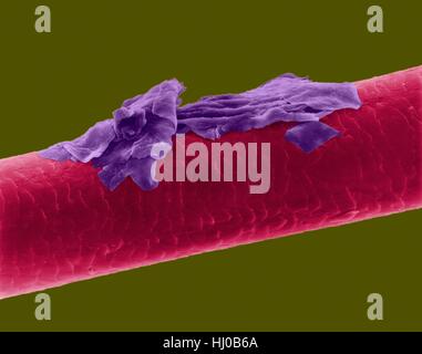 Menschliches Haar Schuppen, farbige scanning Electron Schliffbild (SEM). Die äußere Schicht des Haares (Cuticula) hat überlappende Schuppen aus Keratin. Diese Skalen werden gedacht, um zu verhindern, dass Haare Matten zusammen. Haar besteht aus faserigen Protein Keratin genannt. Intern gliedert sich Haarschaft in drei konzentrischen Hüllen (Schichten) genannt Medulla, Kortex äußeren Cuticula. Das Haar ist nicht lebendes Gewebe. Haare wachsen aus der Haarwurzel (Birne) in Haut eingebettet. Haarwuchs tritt auf, wenn die epidermale Zellen auf Basis der Haarwurzel teilen. Das Haar ist nicht lebendes Gewebe. Vergrößerung: X115 wenn kürzeste Achse bei 25 Millimetern gedruckt. Stockfoto