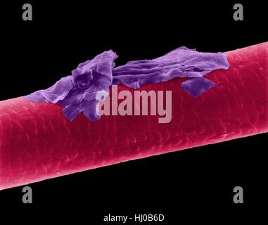 Menschliches Haar Schuppen, farbige scanning Electron Schliffbild (SEM). Die äußere Schicht des Haares (Cuticula) hat überlappende Schuppen aus Keratin. Diese Skalen werden gedacht, um zu verhindern, dass Haare Matten zusammen. Haar besteht aus faserigen Protein Keratin genannt. Intern gliedert sich Haarschaft in drei konzentrischen Hüllen (Schichten) genannt Medulla, Kortex äußeren Cuticula. Das Haar ist nicht lebendes Gewebe. Haare wachsen aus der Haarwurzel (Birne) in Haut eingebettet. Haarwuchs tritt auf, wenn die epidermale Zellen auf Basis der Haarwurzel teilen. Das Haar ist nicht lebendes Gewebe. Vergrößerung: X115 wenn kürzeste Achse bei 25 Millimetern gedruckt. Stockfoto