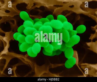 Farbige scanning Electron Schliffbild (SEM) von Enterococcus Faecalis (früher bekannt als Streptococcus Faecalis), Gram-positive, kokkoiden intramolekulare (teilen); Ursachen Haut Wundinfektionen wie verbrannte Haut-Syndrom, Scharlach, Erysipel Impetigo. Gruppe Streptococcus.Enterococcus faecalis Stockfoto