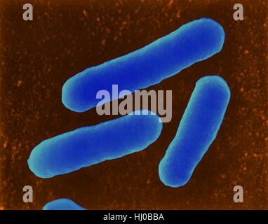 Farbige scanning Electron Schliffbild (SEM) von E.coli (Escherichia coli), Aufteilung, hämorrhagische 0157: H7-Stamm. Escherichia coli ist ein Gram-Negative, antirassistischen anaeroben, enterale, Stab intramolekulare. Dieses Bakterium wurde isoliert aus menschlichen Darm ist in der Regel Bestandteil menschlichen Tier Mikrobiota. Die meisten e. coli Stockfoto