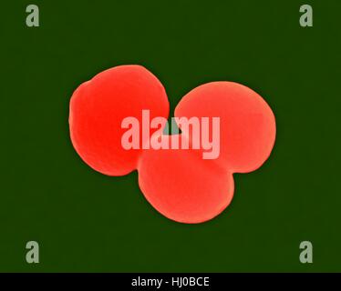 Farbige scanning Electron Schliffbild (SEM) von Staphylococcus Aureus, Gram-Positive, MRSA, Coccus intramolekulare (teilen); Lebensmittelvergiftung, Toxic Shock Syndrom Haut Wunde Infektionen wie verbrüht Haut-Syndrom, Scharlach, Erysipel Impetigo verursacht. Methicillin-resistente Staphylococcus Aureus (MRSA) Stockfoto