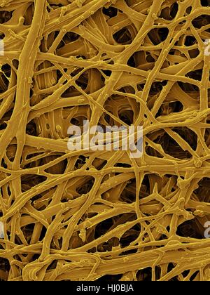 Farbige scanning Electron Schliffbild (SEM) Huhn Eierschale innere Membran (Gallus Gallus Domesticus). Die hier gezeigte ist Eierschale innere Membran, die aus Proteinfasern (interne an harten Eierschalen) besteht. Verschiedene Membranen sind um Embryo Vogelei gefunden. Die innere Membran der Eierschale Stockfoto