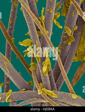 Farbige scanning Electron Schliffbild (SEM) Pet dander.dog Haar, abgestorbene Hautschüppchen Katzenhaare (Katze-hair.brown,dog-hair.purple,dander.yellow). Hund-Katzen produzieren menschlichen Allergene. Haustier Dander ist Material vom Körper von verschiedenen Tieren (häufig Katzen Hunde) vergossen. Es kann Schuppen getrocknete Haut Haare enthalten. Stoffen im Stockfoto