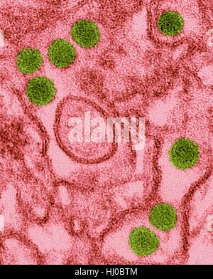 Farbige Transmission Electron Schliffbild (TEM) Zika Viruspartikel (grün) in der Niere epithelialen Zellen (Vero E6) isoliert. Zika Viren haben dichten Kern umgeben von Briefumschlag (40nm Größe). Zika-Virus ist, dass RNA (Ribonukleinsäure) Virus in Familie Flaviviridae Zika Fieber oder Zika verursacht Stockfoto