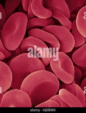 Menschlichen Erythrozyten, farbige scanning Electron Schliffbild (SEM). Rote Blutkörperchen (Erythrozyten) oder Erythrozyten, sind die allgemeinste Art der Blutkörperchen bei Wirbeltieren. Sie engagieren sich im Körpergewebe Sauerstoff bereitzustellen. Erythrozyten nehmen Sauerstoff in den Lungen oder Kiemen lassen Sie ihn in das Gewebe beim Quetschen durch Stockfoto