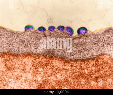 HIV-Infektion, farbige Transmission Electron Schliffbild (TEM). Reifen Sie Virus angehende Freisetzung von HIV in menschliche Lymphgewebe (RNA-Virus, Familie Retroviridae). In Retroviren Nukleokapsid Knospen direkt durch cytoplasmatischen Membran. Dies erzeugt behüllte Virion während der Release-Prozess. HIV (human Stockfoto