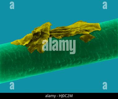 Menschliches Haar Schuppen, farbige scanning Electron Schliffbild (SEM). Die äußere Schicht des Haares (Cuticula) hat überlappende Schuppen aus Keratin. Diese Skalen werden gedacht, um zu verhindern, dass Haare Matten zusammen. Haar besteht aus faserigen Protein Keratin genannt. Intern gliedert sich Haarschaft in drei konzentrischen Hüllen (Schichten) genannt Medulla, Kortex äußeren Cuticula. Das Haar ist nicht lebendes Gewebe. Haare wachsen aus der Haarwurzel (Birne) in Haut eingebettet. Haarwuchs tritt auf, wenn die epidermale Zellen auf Basis der Haarwurzel teilen. Das Haar ist nicht lebendes Gewebe. Vergrößerung: X115 wenn kürzeste Achse bei 25 Millimetern gedruckt. Stockfoto