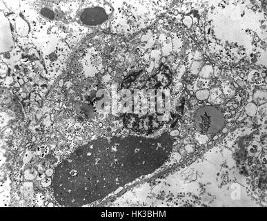 Eine Transmission Electron Schliffbild des Ebola-Virus in ein Exemplar der menschlichen Lebergewebe vergrößert 4000 X. Die Inkubationszeit für Ebola reicht von 2 bis 21 Tage mit abrupten Beginn der Erkrankung, charakterisiert durch Fieber, Kopfschmerzen, Gelenk und Muskelschmerzen, Halsschmerzen und Schwäche, gefolgt von Durchfall, Erbrechen und Magenschmerzen, 1978. Bild mit freundlicher Genehmigung CDC/B.G. Partin. Stockfoto