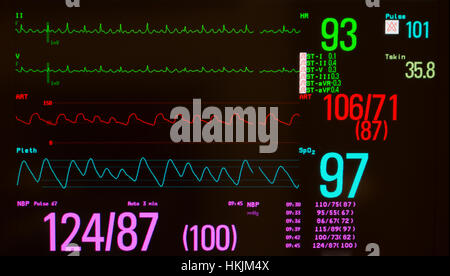 Monitor mit schwarzen Bildschirm, das EKG mit Vorhofflimmern flattern auf grüne Linien, arterieller Blutdruck auf rote Linie und Sauerstoffsättigung auf blauen Linie, Stockfoto