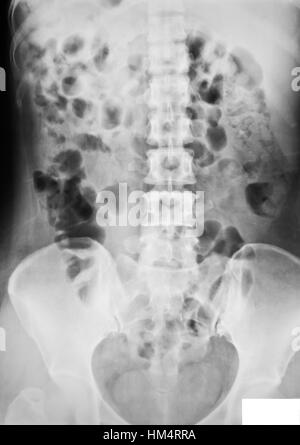 Sammlung von x-ray Stockfoto