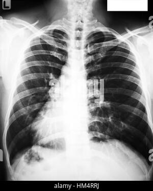 Sammlung von x-ray Stockfoto