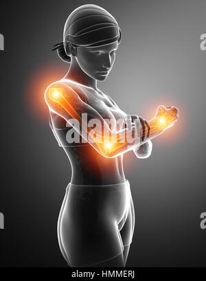 menschlichen Körper Anatomie mit Gelenkschmerzen Stockfoto