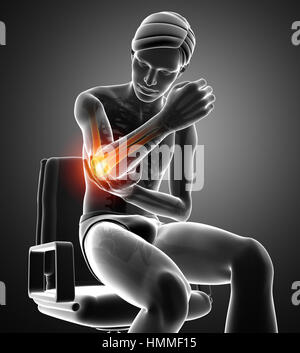 menschlichen Körper Anatomie mit Gelenkschmerzen Stockfoto