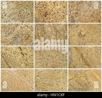 Zwölf natürlichen Kalkstein Hintergrund oder Texturen. Die echte Farbe. Ohne Sättigung der Farben. Stockfoto