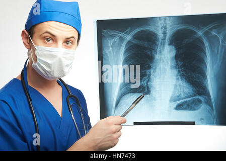 junger Arzt zeigen Röntgenuntersuchung der Brust isoliert auf weiss Stockfoto