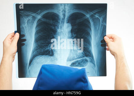 Röntgenbild der Lunge in der Hand der Krankenschwester isoliert auf weiss Stockfoto