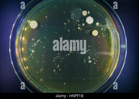 Petrischalen mit wachsender Mikroflora. Hygiene Räumlichkeiten Restaurants zu studieren. Lebensmittelsicherheit Stockfoto