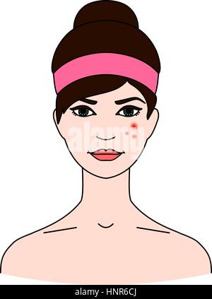 Das Gesicht der Frau mit Akne. Das Konzept der Haut gesundheitliche Probleme. Dermatologische Erkrankungen. Isoliert auf weiss. Stock Vektor