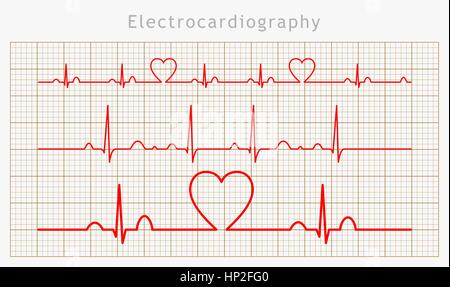 Vektor Herz EKG Karten set Stock Vektor