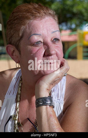 Datei-Pic: Smithville, Texas, USA. 15. Juli 2011. Norma McCorvey, die anonyme Kläger bekannt als Jane Roe in dem Urteil des Obersten Gerichtshofs Wahrzeichen 1973 Roe vs. Wade Legalisierung der Abtreibung in den Vereinigten Staaten, schwingt in einem lokalen Park.  McCorvey starb, 18. Februar 2017 in einem betreutes Wohnen-Center in Katy, Texas Credit: Bob Dämmrich/Alamy Live News Stockfoto