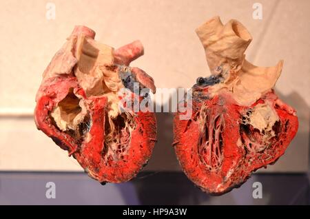 Menschenherz Display Stockfoto