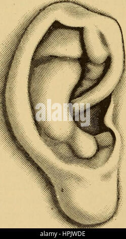 "Erkrankungen des Ohrs: ein Lehrbuch für Praktiker und Studenten der Medizin" (1900) Stockfoto