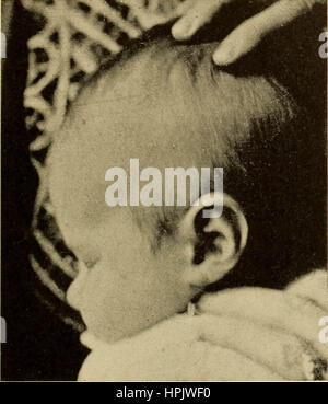 "Erkrankungen des Ohrs: ein Lehrbuch für Praktiker und Studenten der Medizin" (1900) Stockfoto
