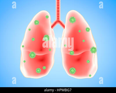 3D Rendering Lungenerkrankung mit Bakterienzellen Stockfoto