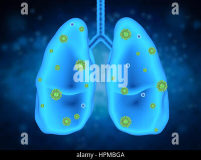 3D Rendering Lungenerkrankung mit Bakterienzellen Stockfoto