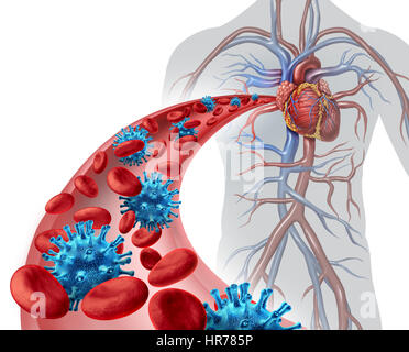 Blut-Virus-Infektion medizinisches Konzept als einen menschlichen Körper mit einer Arterie mit mikroskopisch kleinen Erreger und Erythrozyten von Krankheit bedroht. Stockfoto