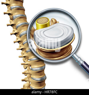 Anatomie der Lendenwirbelsäule segment medizinisches Konzept als eine enge des menschlichen Skeletts zurück als ein Wirbelkörper Vergrößerung. Stockfoto