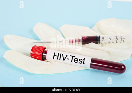 Blut Sammlung Probenröhrchen mit HIV-Test-Label im Labor. Stockfoto