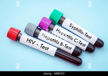 Blut Sammlung Probenröhrchen für HIV, HCV, HBV und Shyphilis im Labor testen. Stockfoto