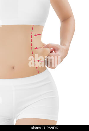 Frau packte Haut auf ihre Flanken mit Zeichnung rote Pfeile, Gewicht zu verlieren und Fettabsaugung Cellulite Entfernung Konzept, isoliert auf weißem Hintergrund. Stockfoto