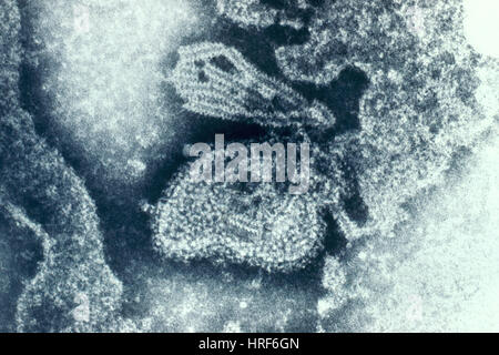 Paramyxovirus, Mumps-Virus, TEM Stockfoto