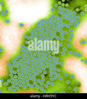 Poliovirus Typ 1, TEM Stockfoto