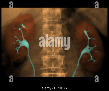 IVP normale Nieren Stockfoto