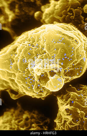 HIV-1 infizierten T4-Lymphozyten, SEM Stockfoto