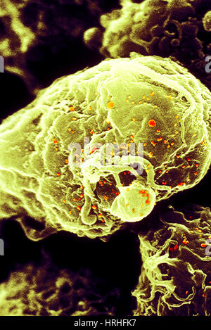 HIV-1 infizierten T4-Lymphozyten, SEM Stockfoto
