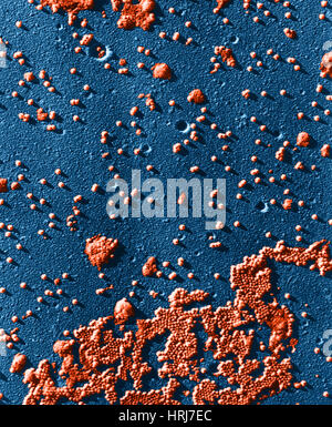 Polio-Virus, TEM Stockfoto