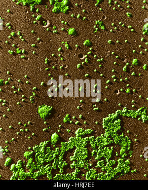 Polio-Virus, TEM Stockfoto
