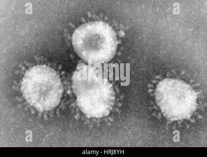 SARS-Coronavirus, EM Stockfoto