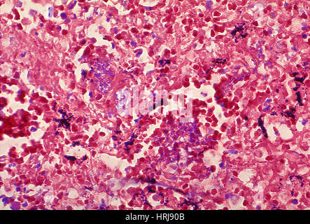 Milzbrand, Bacillus Anthracis Bakterien, LM Stockfoto